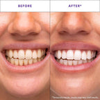 Daily Whitening & Care Strips